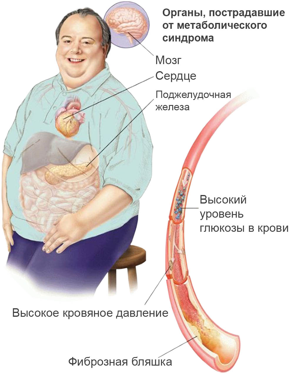Органы-мишени при метаболическом синдроме
