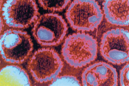 Модифицированный вирус вызывает гибель раковых клеток