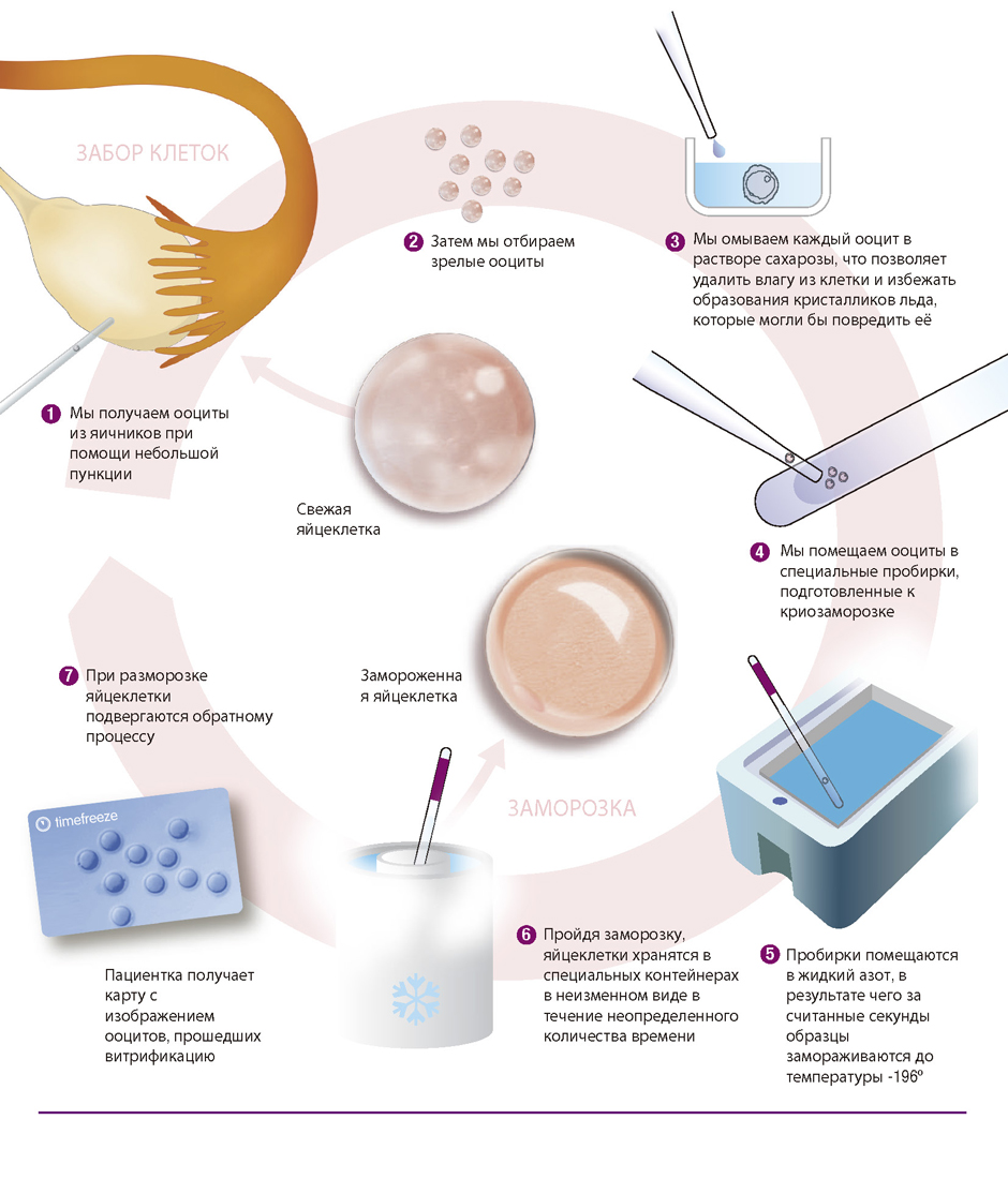 Виртификация яйцеклеток