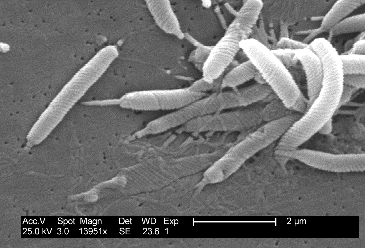 Коварный микроб хеликобактер пилори под микроскопом