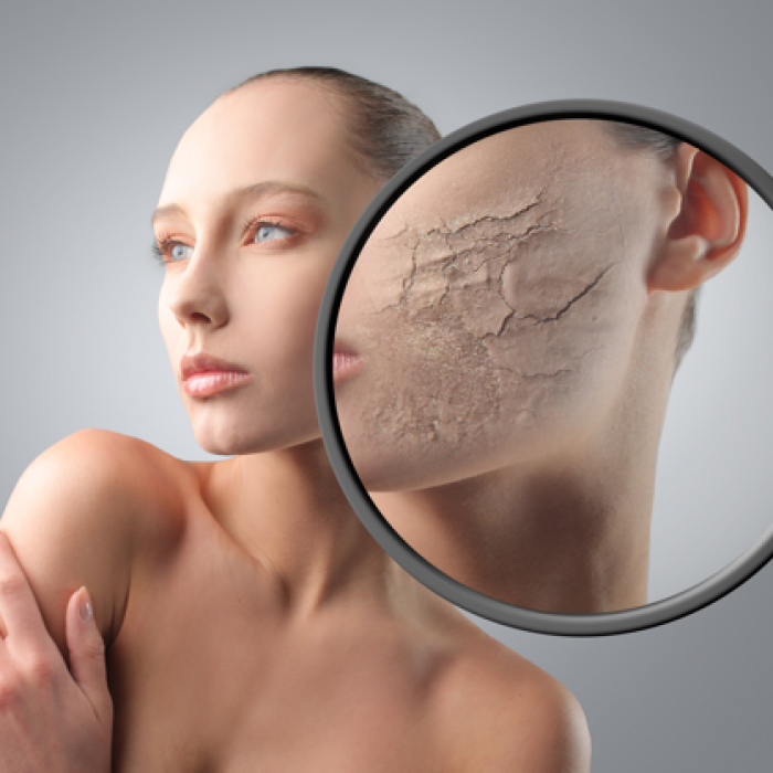 Сухость кожи - это не только косметическая проблема, но и отличительный симптом болезни