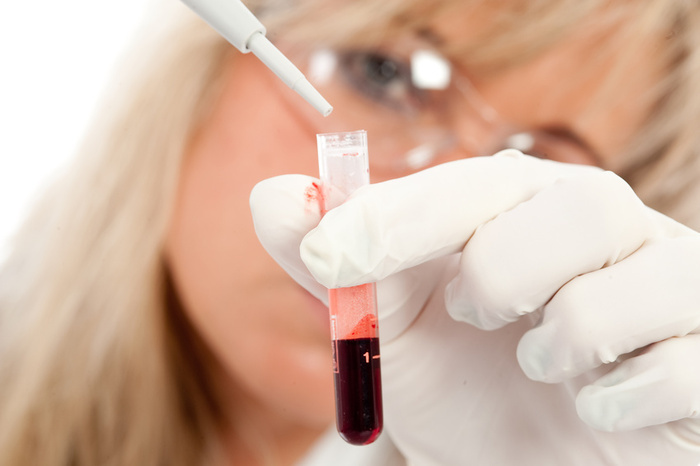 Анализ крови на гормоны сдавать обязательно для постановки достоверного диагноза
