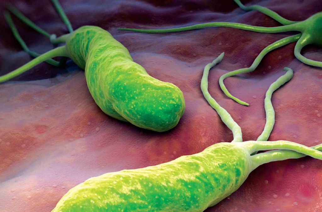 Helicobacter pylori – причина язвенной болезни желудка