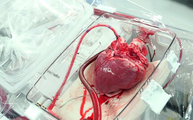 Сердце во время операции
